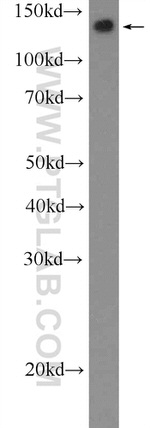 PARP10 Antibody in Western Blot (WB)