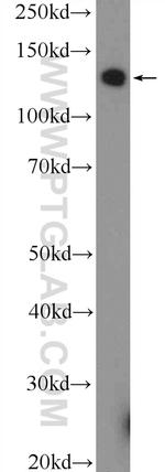 PARP10 Antibody in Western Blot (WB)