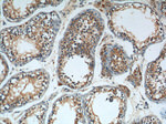C1orf9 Antibody in Immunohistochemistry (Paraffin) (IHC (P))