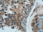 C1orf9 Antibody in Immunohistochemistry (Paraffin) (IHC (P))