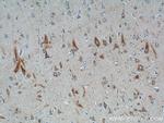 C1orf9 Antibody in Immunohistochemistry (Paraffin) (IHC (P))