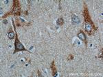 C1orf9 Antibody in Immunohistochemistry (Paraffin) (IHC (P))