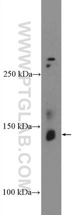 C1orf9 Antibody in Western Blot (WB)
