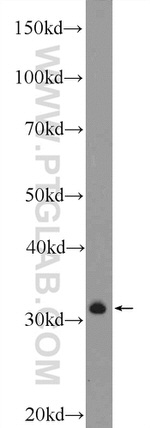 CLEC12B Antibody in Western Blot (WB)