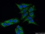 MAP9 Antibody in Immunocytochemistry (ICC/IF)