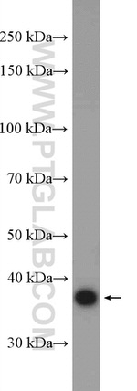 MAP9 Antibody in Western Blot (WB)