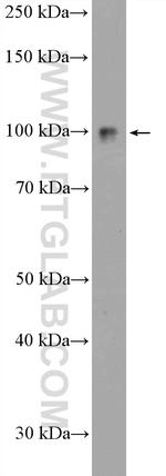 KIAA0776 Antibody in Western Blot (WB)
