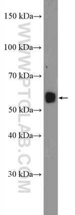 C15orf27 Antibody in Western Blot (WB)