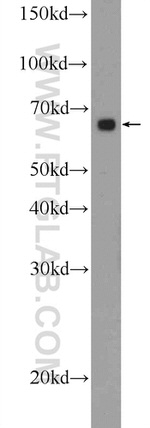 MBTD1 Antibody in Western Blot (WB)