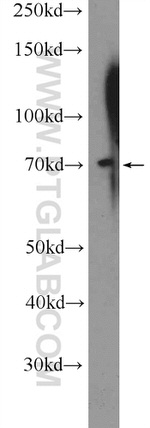 MBTD1 Antibody in Western Blot (WB)