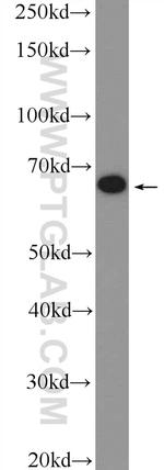 MBTD1 Antibody in Western Blot (WB)