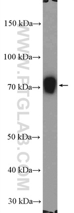 MBTD1 Antibody in Western Blot (WB)