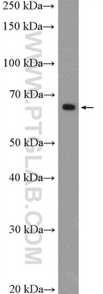 MBTD1 Antibody in Western Blot (WB)