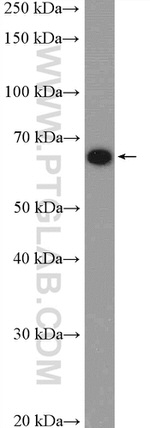 MBTD1 Antibody in Western Blot (WB)