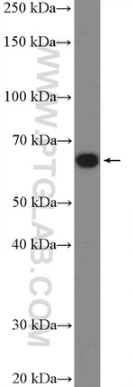 MBTD1 Antibody in Western Blot (WB)