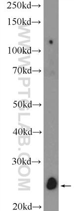 C12orf69 Antibody in Western Blot (WB)
