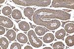 RIMKLB Antibody in Immunohistochemistry (Paraffin) (IHC (P))