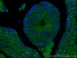 RIMKLB Antibody in Immunohistochemistry (PFA fixed) (IHC (PFA))
