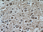 TTC5 Antibody in Immunohistochemistry (Paraffin) (IHC (P))