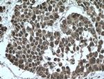 TTC5 Antibody in Immunohistochemistry (Paraffin) (IHC (P))