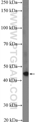 TTC5 Antibody in Western Blot (WB)