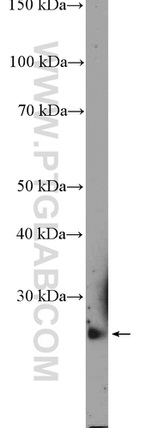 C19orf20 Antibody in Western Blot (WB)