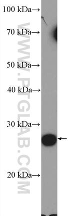 C19orf20 Antibody in Western Blot (WB)