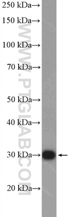 C1orf103 Antibody in Western Blot (WB)