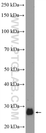 C1orf103 Antibody in Western Blot (WB)