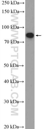 C1orf103 Antibody in Western Blot (WB)