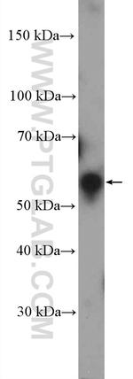 GHDC Antibody in Western Blot (WB)