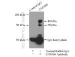 ZNF606 Antibody in Immunoprecipitation (IP)