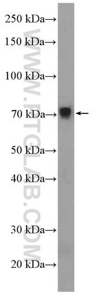 ZNF606 Antibody in Western Blot (WB)
