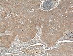 RGS11 Antibody in Immunohistochemistry (Paraffin) (IHC (P))