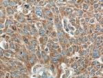 RGS11 Antibody in Immunohistochemistry (Paraffin) (IHC (P))
