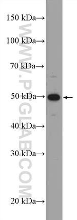 RGS11 Antibody in Western Blot (WB)