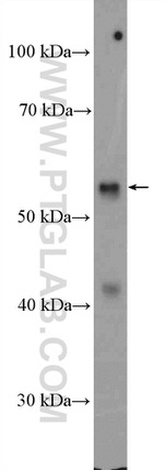 RGS11 Antibody in Western Blot (WB)