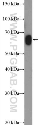 ZNF470 Antibody in Western Blot (WB)