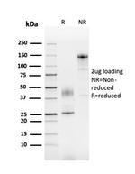SERBP1/PAI-RBP1 Antibody in SDS-PAGE (SDS-PAGE)