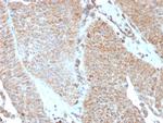 SERBP1/PAI-RBP1 Monoclonal Antibody (SERBP1, 3493)