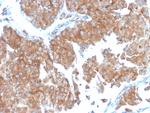 SERBP1/PAI-RBP1 Monoclonal Antibody (SERBP1, 3498)