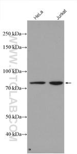 ZBED1 Antibody in Western Blot (WB)