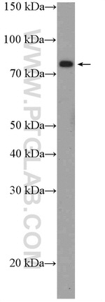 ZBED1 Antibody in Western Blot (WB)