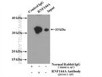 RNF144A Antibody in Immunoprecipitation (IP)