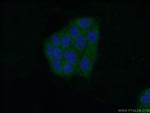 HDHD2 Antibody in Immunocytochemistry (ICC/IF)