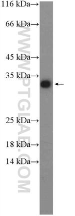 HDHD2 Antibody in Western Blot (WB)