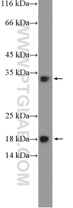 HDHD2 Antibody in Western Blot (WB)