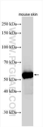 KRT71 Antibody in Western Blot (WB)