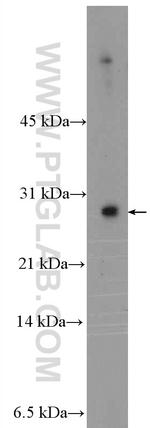 MYEOV2 Antibody in Western Blot (WB)