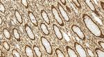 SMEK1 Antibody in Immunohistochemistry (Paraffin) (IHC (P))